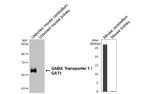 GAT-1 Antibody in Western Blot (WB)