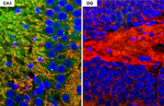 GluR2 Recombinant Mouse Monoclonal Antibody (GT209)