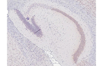 KCNB1 Antibody in Immunohistochemistry (Paraffin) (IHC (P))