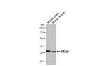 ATAD1 Antibody in Western Blot (WB)