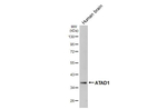 ATAD1 Antibody in Western Blot (WB)