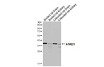 ATAD1 Recombinant Mouse Monoclonal Antibody (GT275)