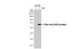 Zika Virus NS3 Recombinant Mouse Monoclonal Antibody (GT285)