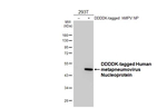 Metapneumovirus Nucleoprotein Recombinant Mouse Monoclonal Antibody (GT298)