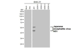 Japanese Encephalitis Virus NS1 Recombinant Mouse Monoclonal Antibody (GT315)