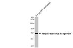Yellow Fever Virus NS3 Antibody in Western Blot (WB)