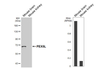 PEX5L Recombinant Mouse Monoclonal Antibody (GT278)