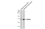 PEX5L Antibody in Western Blot (WB)
