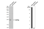 CD79a Recombinant Mouse Monoclonal Antibody (GT313)
