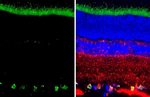 RBPMS Antibody in Immunohistochemistry (Paraffin) (IHC (P))
