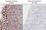 Claudin 18.2 Antibody in Immunohistochemistry (Paraffin) (IHC (P))