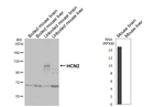 HCN2 Recombinant Mouse Monoclonal Antibody (GT98)