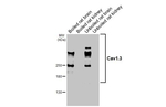 CaV1.3 Recombinant Mouse Monoclonal Antibody (GT265)