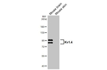 KV1.4 (KCNA4) Recombinant Mouse Monoclonal Antibody (GT240)
