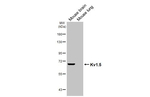 KV1.5 (KCNA5) Recombinant Mouse Monoclonal Antibody (GT241)