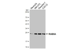 RAB5A Recombinant Mouse Monoclonal Antibody (GT318)