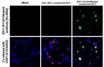 IDH1 (R132H) Recombinant Rabbit Monoclonal Antibody (HL4884)