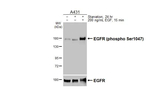 Phospho-EGFR (Ser1047) Antibody in Western Blot (WB)