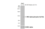 Phospho-IRE1 alpha (Ser724) Antibody in Western Blot (WB)