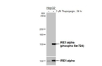 Phospho-IRE1 alpha (Ser724) Antibody in Western Blot (WB)