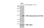 Phospho-IRE1 alpha (Ser724) Antibody in Western Blot (WB)