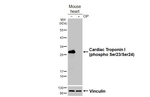 Phospho-Cardiac Troponin I (Ser23, Ser24) Recombinant Rabbit Monoclonal Antibody (HL3796)