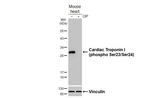 Phospho-Cardiac Troponin I (Ser23, Ser24) Antibody in Western Blot (WB)