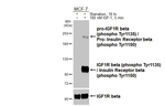Phospho-IGF1R beta (Tyr1135, Tyr1150) Recombinant Rabbit Monoclonal Antibody (HL3614)