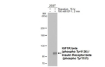 Phospho-IGF1R beta (Tyr1316) Recombinant Rabbit Monoclonal Antibody (HL4099)
