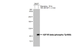 Phospho-IGF1R beta (Tyr950) Recombinant Rabbit Monoclonal Antibody (HL3607)