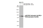 Phospho-RSK1/RSK2 (Ser380, Ser386) Recombinant Rabbit Monoclonal Antibody (HL3818)