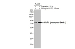 Phospho-YAP1 (Ser61) Recombinant Rabbit Monoclonal Antibody (HL3721)