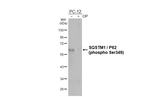 Phospho-SQSTM1 (Ser349) Recombinant Rabbit Monoclonal Antibody (HL5102)