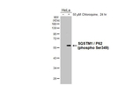 Phospho-SQSTM1 (Ser349) Antibody in Western Blot (WB)
