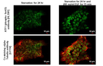 Phospho-ATF1 (Ser63) Recombinant Rabbit Monoclonal Antibody (HL3581)