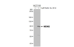 MDM2 Recombinant Rabbit Monoclonal Antibody (HL5170)
