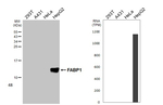 FABP1 Recombinant Rabbit Monoclonal Antibody (HL5290)