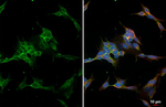 CD56 Recombinant Rabbit Monoclonal Antibody (HL4992)