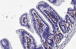 CD56 Antibody in Immunohistochemistry (Paraffin) (IHC (P))