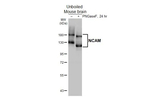 CD56 Antibody in Western Blot (WB)