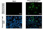 Adenovirus Hexon Recombinant Rabbit Monoclonal Antibody (HL4593)