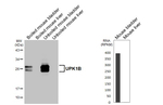 UPK1B Recombinant Rabbit Monoclonal Antibody (HL4754)