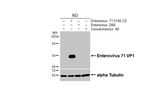 Enterovirus 71 VP1 Antibody in Western Blot (WB)