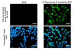 Helicobacter pylori Urease B Recombinant Rabbit Monoclonal Antibody (HL4834)