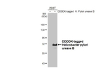 Helicobacter pylori Urease B Antibody in Western Blot (WB)