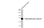 Helicobacter pylori Urease B Antibody in Western Blot (WB)