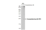 Coxsackievirus A6 VP3 Antibody in Western Blot (WB)