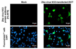 Zika Virus NS3 Recombinant Rabbit Monoclonal Antibody (HL4878)