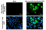 Zika Virus NS1 Recombinant Rabbit Monoclonal Antibody (HL4920)