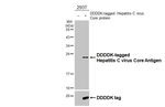 Hepatitis C Virus Core Antigen Antibody in Western Blot (WB)